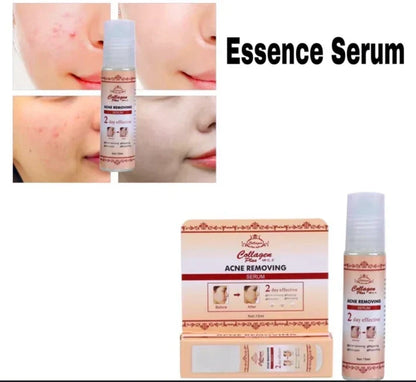 Collagen Plus Vitamin C & E – Original Acne Removal & Brightening Serum