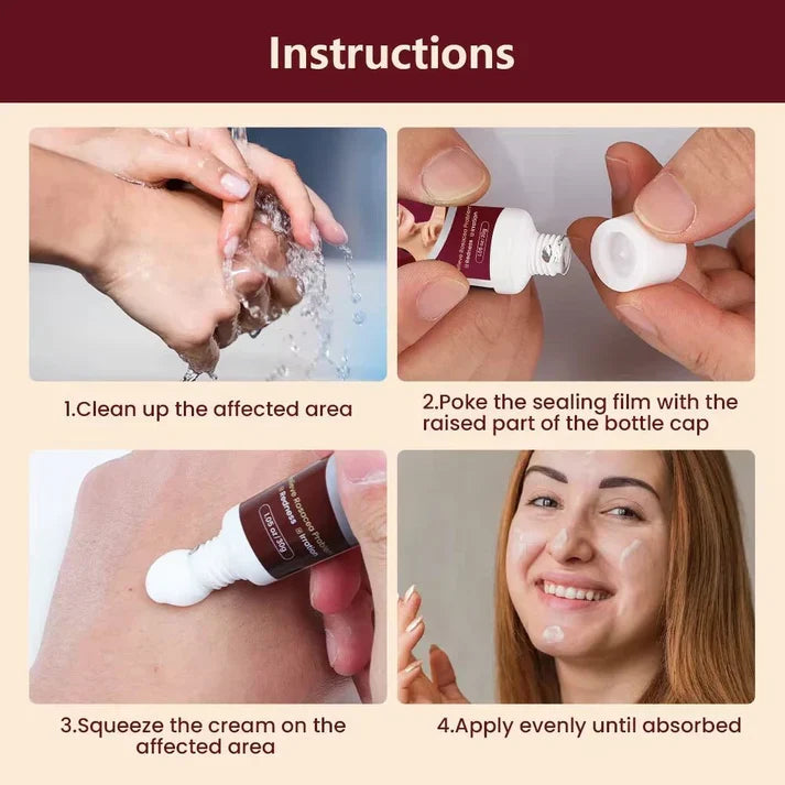 Sumifun Rosacea Relief Cream